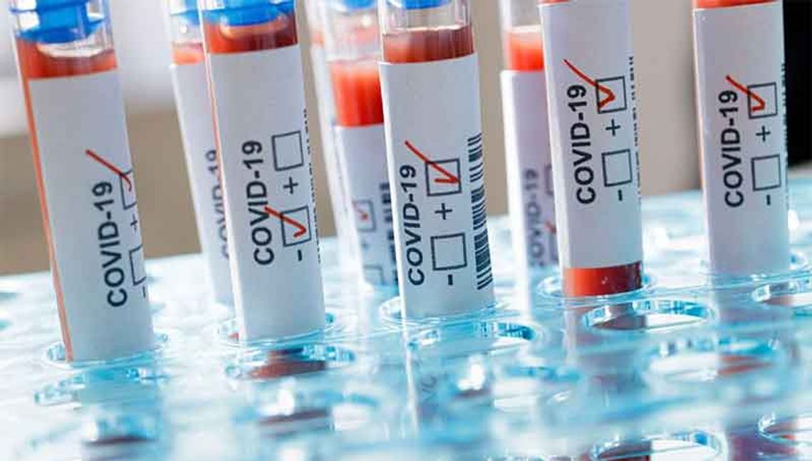 UNIMOT dostarczy 100 tysięcy testów na koronawirusa.